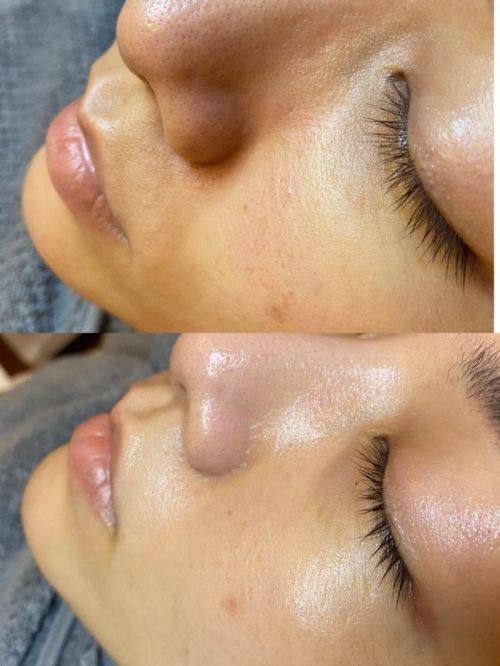 金华常春藤整形美容医疗医院特色项目及技术优势