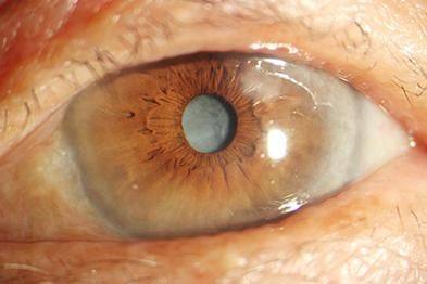 鹰潭市中医院眼科收费价格表/收费标准