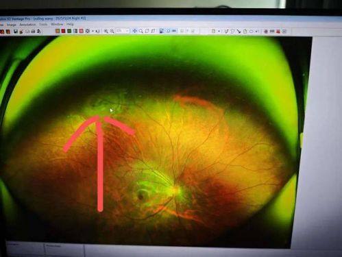 抚顺市中 心医院眼科真人口碑评价怎么样？