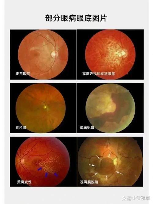 抚顺市中 心医院眼科详细的预约挂号方式及流程