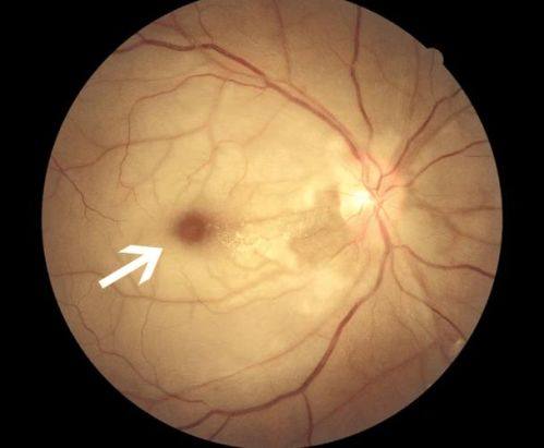 厦门市儿童医院眼科收费价格表/收费标准