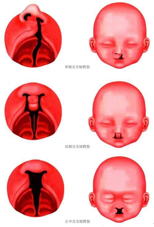 梧州市红十字会医院烧伤整形外科地址电话营业时间