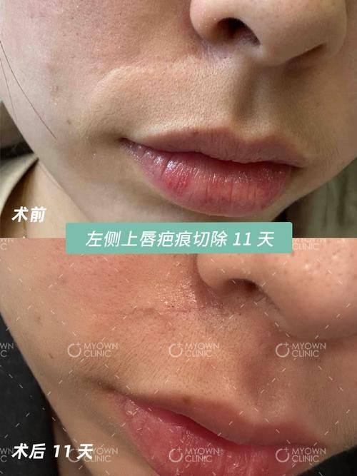 梧州市红十字会医院烧伤整形外科详细的预约挂号方式及流程