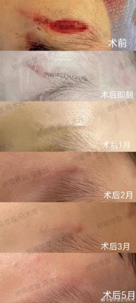 梧州市红十字会医院烧伤整形外科真人口碑评价怎么样?