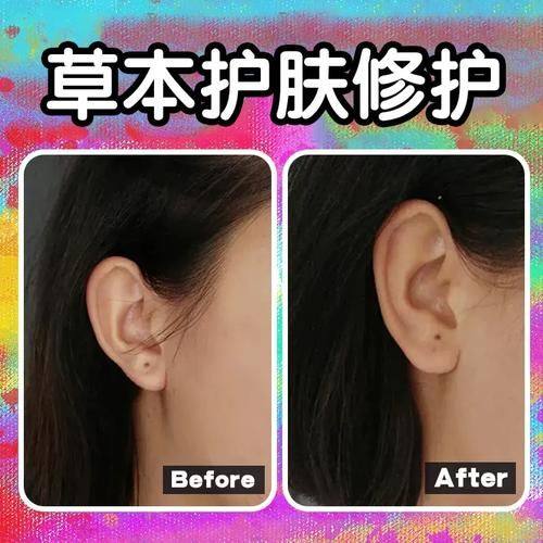 湖南省交通医院整形美容科详细的预约挂号方式及流程