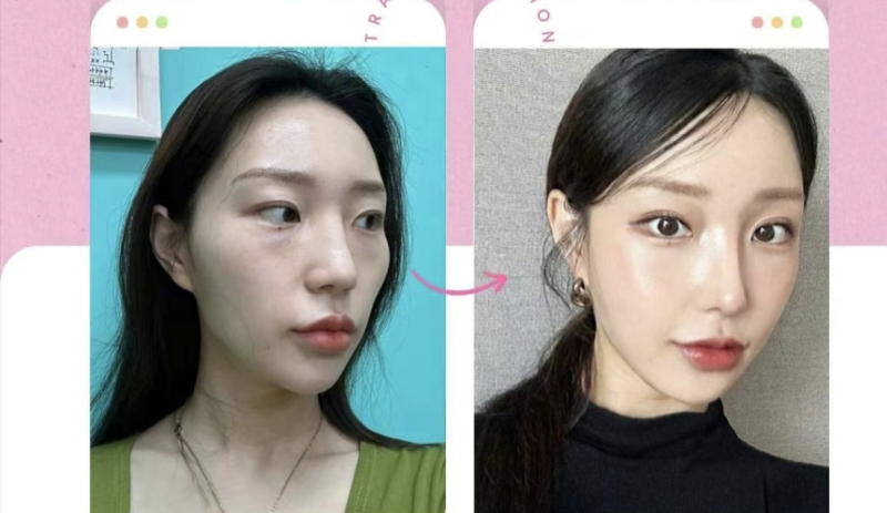 赵文博医生擅长项目