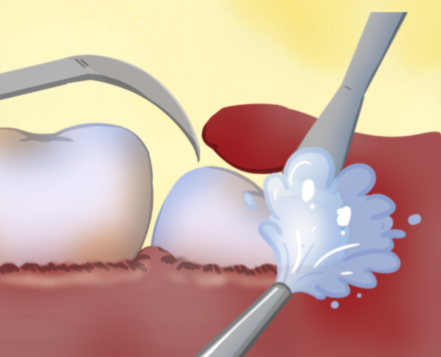 山东泰安肥城张扬口腔收费价格表/收费标准