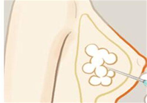 刘喻平医生擅长项目