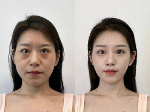 成都娇点医疗美容医院真人口碑评价怎么样？