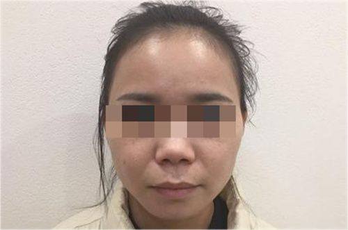 刘喻平医生预约挂号