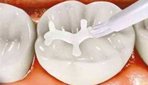 济南历城华医口腔特色项目及技术优势