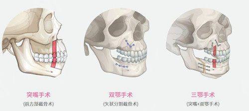刘喻平医生技术优势