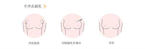 口碑评价及真人实例