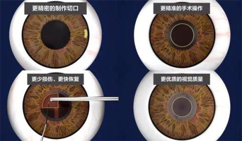 重庆市急救医疗中 心眼科特色项目及技术优势