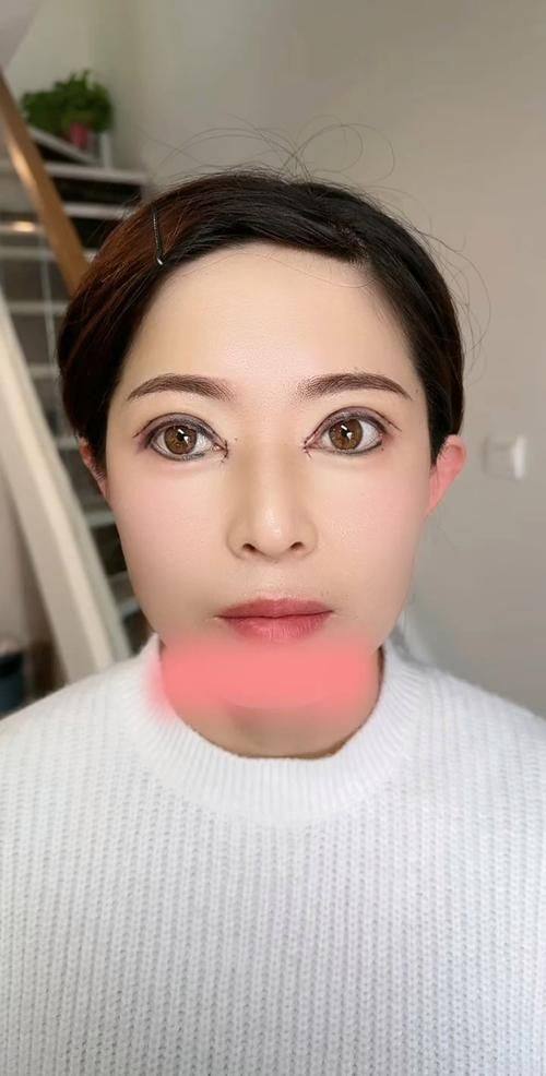 淮南丽颜整形医院是正规医院吗？