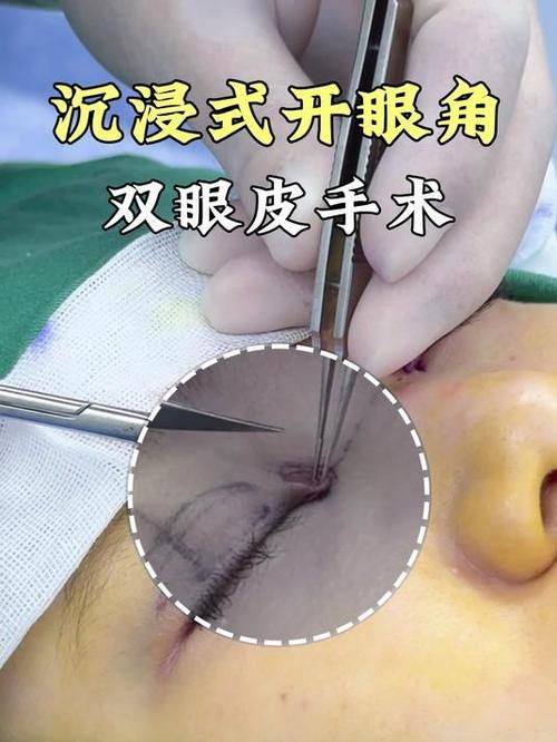 淮南丽颜整形医院地址电话营业时间