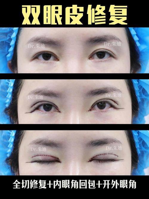 韩国巴诺巴奇整形医院收费价格表/收费标准