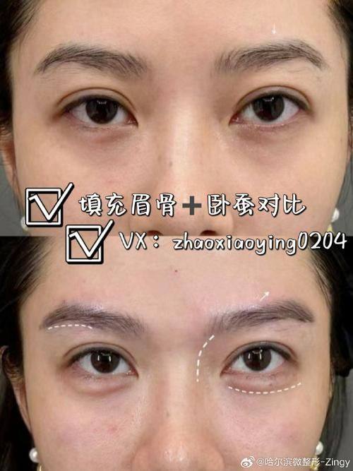 江会芳医生预约挂号