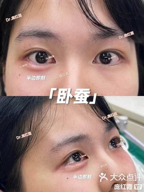 江会芳医生口碑评价及真人实例