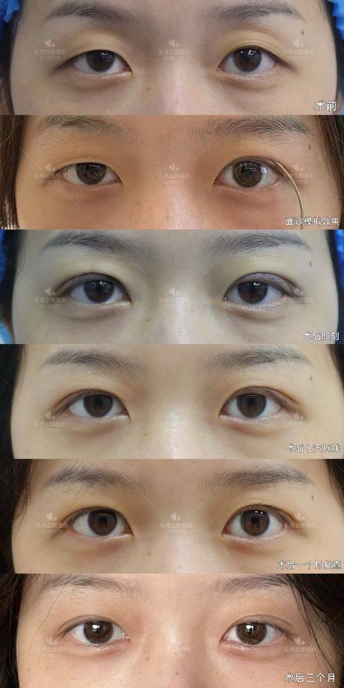 肖文明医生口碑评价及真人实例