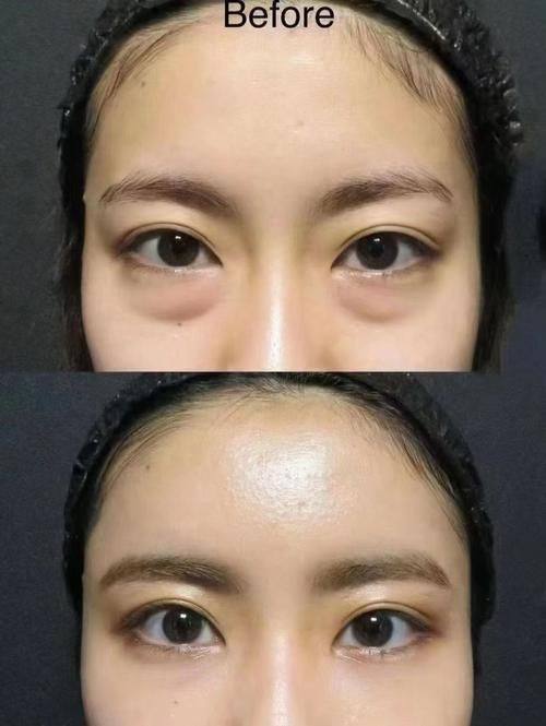 江会芳医生擅长项目