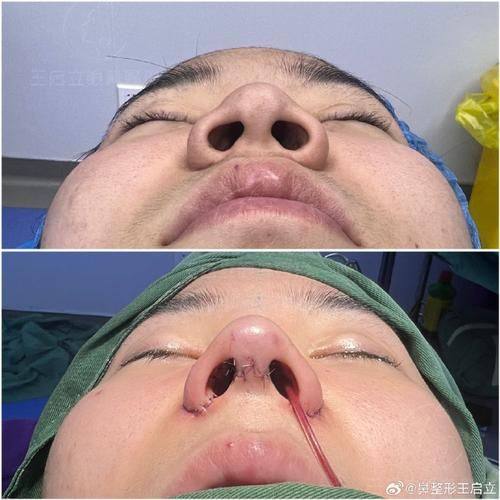 郑州曼蒂整形美容医院特色项目及技术优势