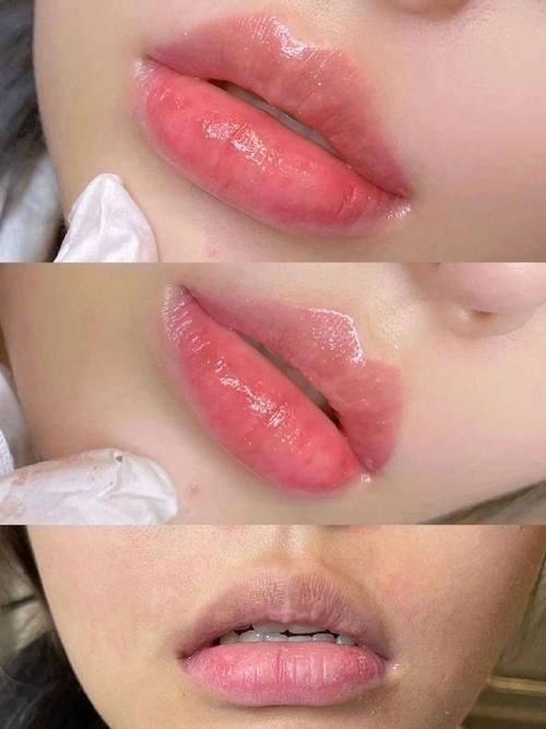 淮南丽颜整形医院特色项目及技术优势