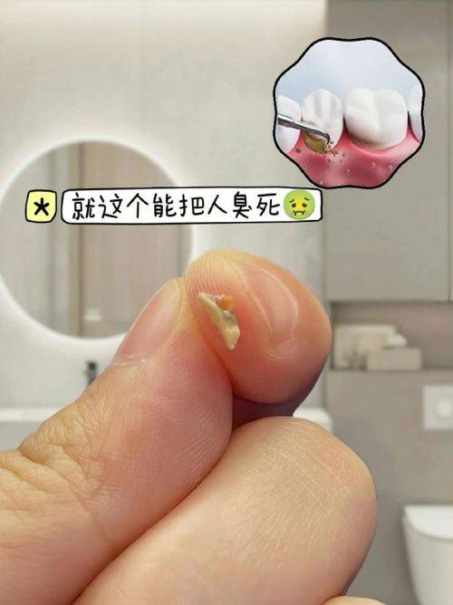 赵冰川医生口碑评价及真人实例