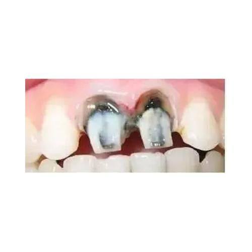 济南历城华医口腔详细的预约挂号方式及流程