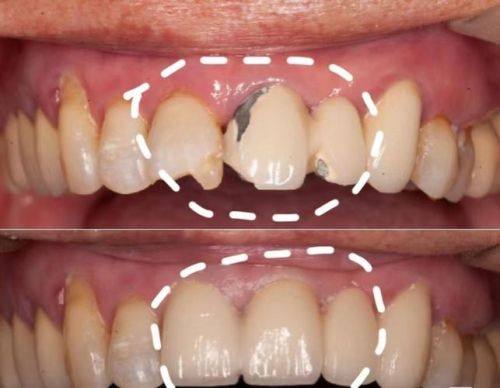 济南韩美口腔医院收费价格表/收费标准