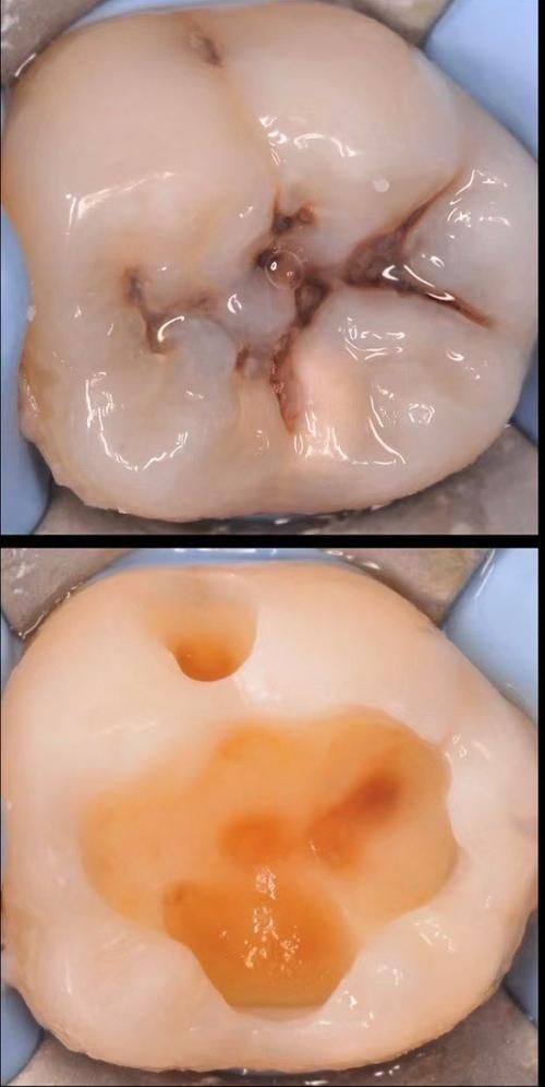 济南历城华医口腔是正规医院吗？