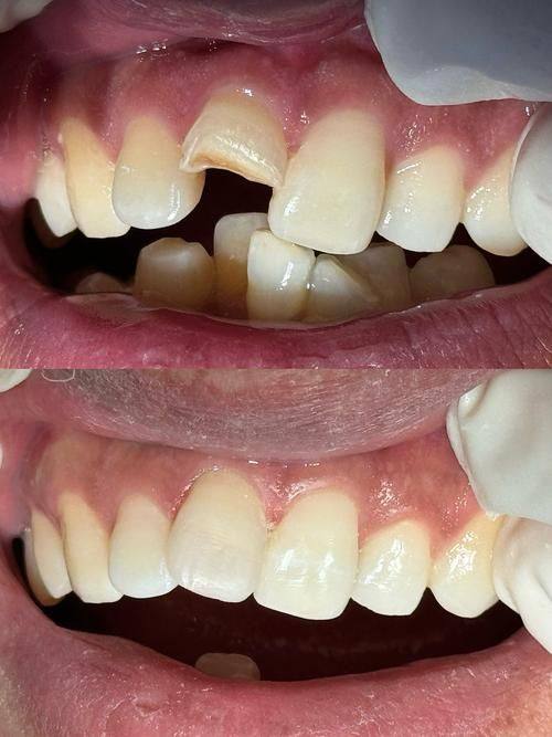 太原皓一口腔真人口碑评价怎么样？