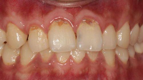 太原皓一口腔地址电话营业时间