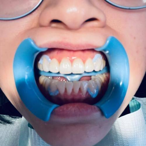 太原皓一口腔特色项目及技术优势