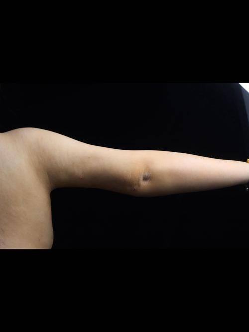 韩国巴诺巴奇整形医院是正规医院吗？