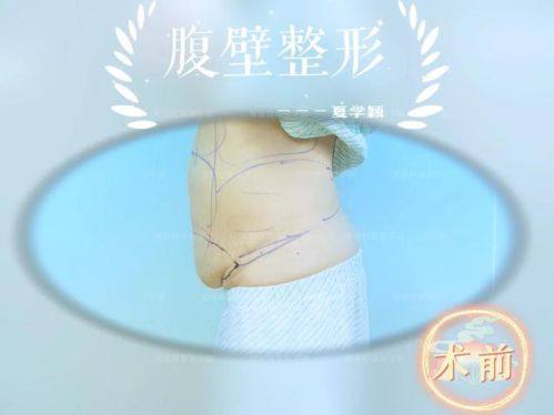 淮南丽颜整形医院详细的预约挂号方式及流程