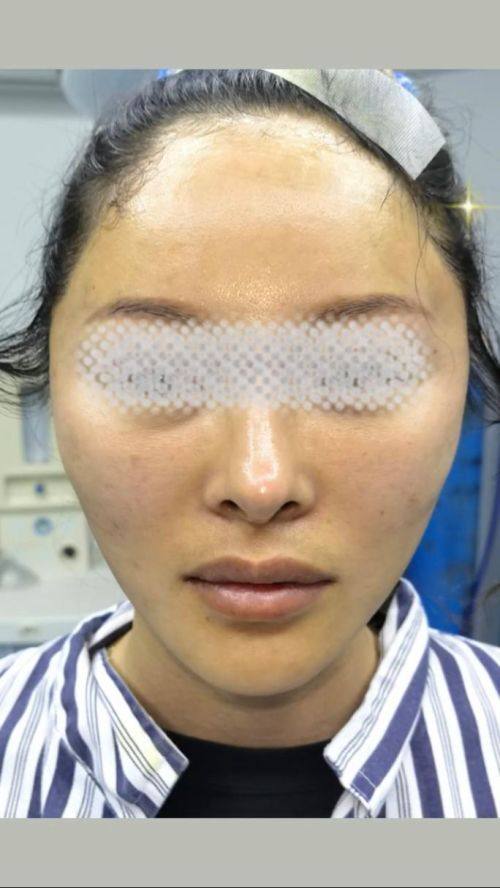 江会芳医生技术优势