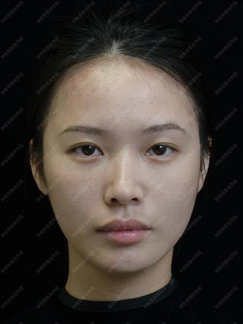 郑州曼蒂整形美容医院真人口碑评价怎么样？