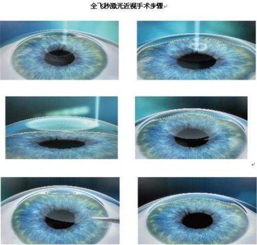 鹤壁淇县眼科医院医生团队实力强大及骨干医生简介