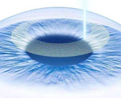 鹤壁淇县眼科医院是正规医院吗？