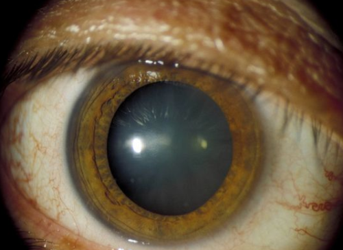 重庆市急救医疗中 心眼科是正规医院吗？