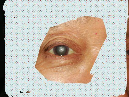 鹤壁淇县眼科医院真人口碑评价怎么样？