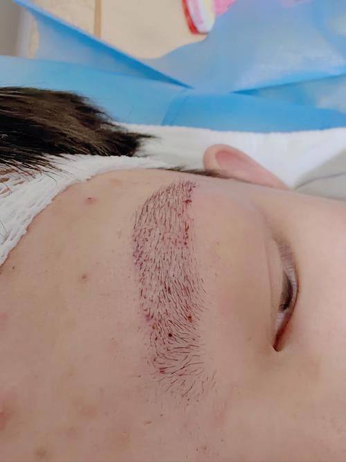 张家界伊佰佳桦美整形医院真人口碑评价怎么样？