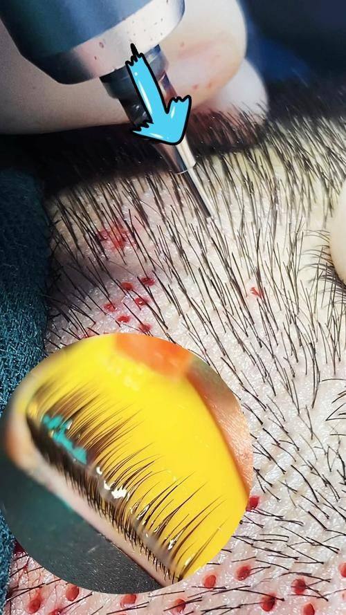 温州市瓯海梦露医疗美容门诊部收费价格表/收费标准