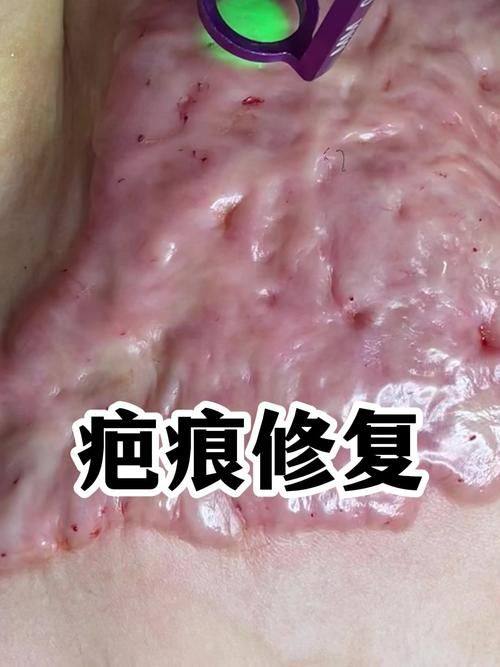 韩国巴诺巴奇整形医院真人口碑评价怎么样？