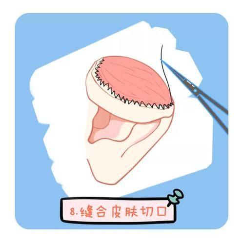 温州市瓯海梦露医疗美容门诊部详细的预约挂号方式及流程