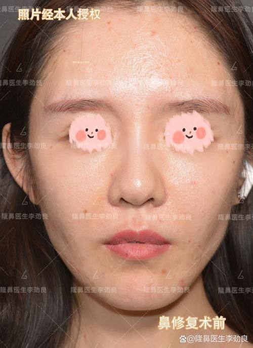 成都娇点医疗美容医院是正规医院吗？