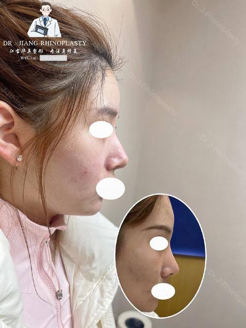 郑州曼蒂整形美容医院是正规医院吗？