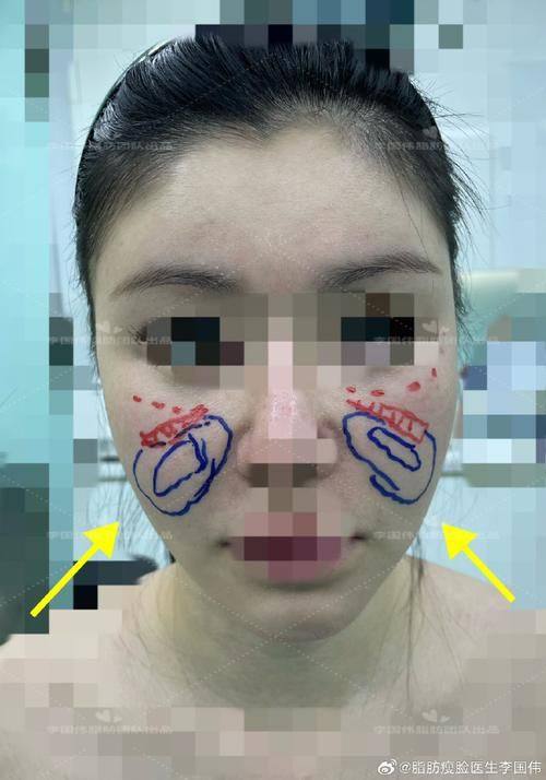 郑州曼蒂整形美容医院详细的预约挂号方式及流程