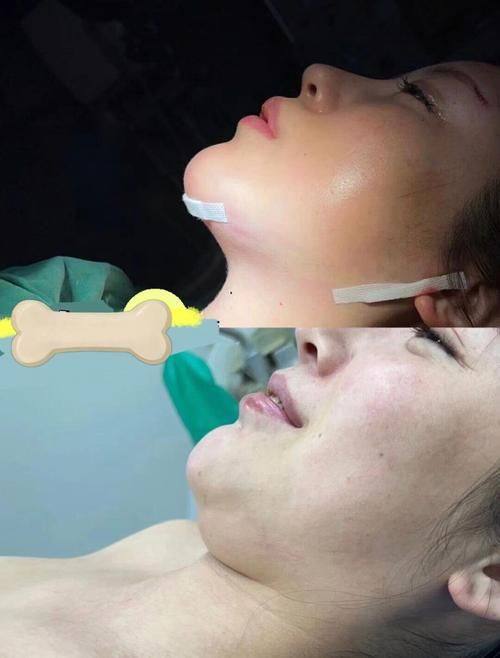 韩国巴诺巴奇整形医院地址电话营业时间